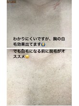 エピラージュ 町田店/全身脱毛