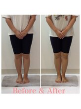 スタイルラボ高松/産後骨盤矯正の効果♪