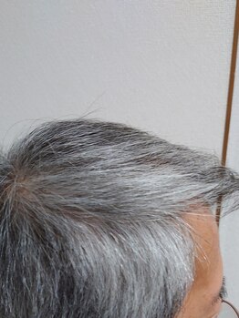 セラフ(Seraph)/頭皮毛髪育毛促進スカルプヘッド