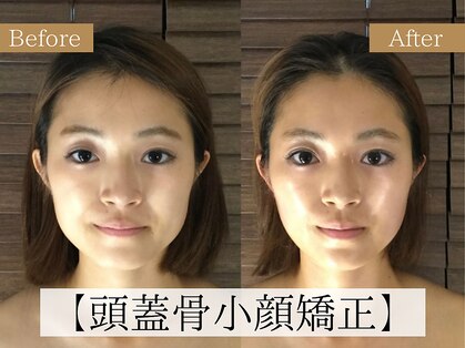 アオン(aon.)の写真