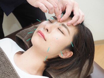めいてるの写真/【しみ・シワケア対策！美容鍼×高浸透美容液導入♪】陶器のように滑らかなで、理想のうるつや肌に◎