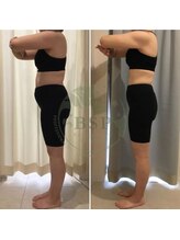 エステティックサロン ピュール ボーテ 東金店/食べて痩せる健康ダイエット