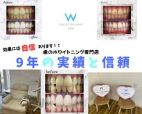 ホワイトニングショップ 太田店