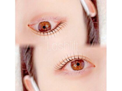 ダズル(DAZZLE)の写真