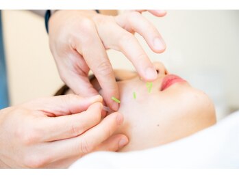 リガーレ鍼灸整骨院の写真/国家資格保有者による本格施術☆整体×鍼灸の施術で根本からアプローチ!美容鍼メニューでお顔悩みも◎