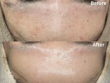 ベリスユイット(BELLIS HUIT)