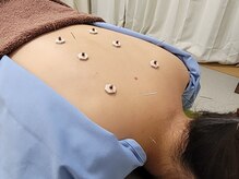 和緩堂/首、肩こり、頭痛にもおすすめ