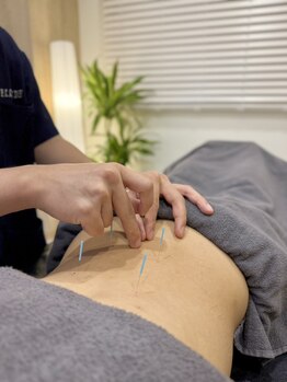 飯田橋駅前鍼灸整骨院/慢性症状に鍼灸【飯田橋/鍼灸】