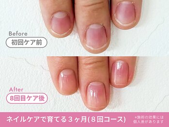 フェリエ(feerie)/Before/After【feerie立川】