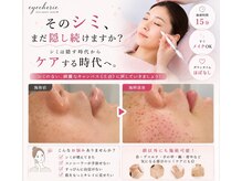 アイシェリー(eyecherie)の雰囲気（濃い・薄いシミ・ニキビ等でお悩みの方に♪透明感のあるお肌へ♪）
