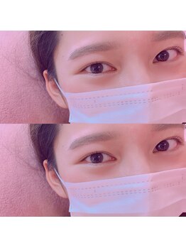 サロン ド ミミ(Salon de 33)/Eye brow×Lash lift