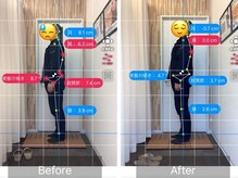 ナオル整体 札幌院(NAORU整体)/札幌円山/整体/姿勢矯正/猫背