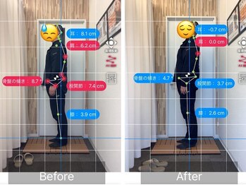ナオル整体 札幌院(NAORU整体)/札幌円山/整体/姿勢矯正/猫背