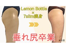 アマテビューティー ドット エヌ(アマテビューティー.N)の雰囲気(脂肪分解レモンボトルで若見えスタイル!温熱ほぐしの組合せ人気)