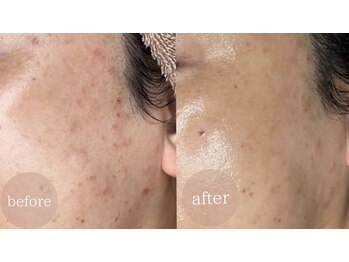 アンドエピ(&epi)/