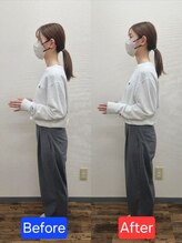 最後の整体 練馬駅前院/肩こりでお悩みの方の姿勢変化