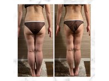 エムズ ビューティー サロン(M's Beauty Salon)の雰囲気（痩身/ダイエット/表参道/青山/渋谷/美脚/くびれ/下半身/セル脂肪）