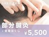 【部分鍼灸+全身ほぐし】気になる部分を血行促進★30~45分(初回75分)
