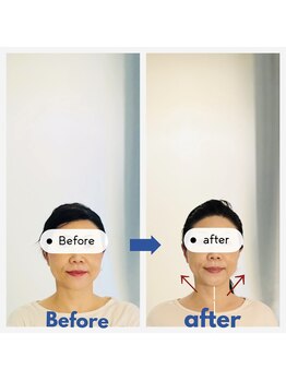 ビューティートワブルームサロン(Beauty Towabloom Salon)/1回で頭・顔が小さくなる!