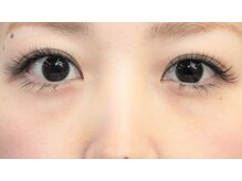 フランキンセンス蘇我店/ボリューム・シングル比較 