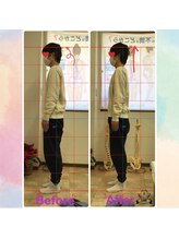 カイロプラクティック コダマ(KODAMA)/姿勢矯正　ビフォーアフター