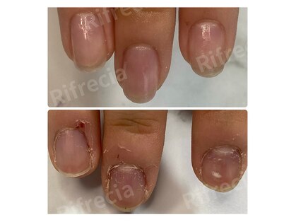 リフレシア(Rifrecia)の写真