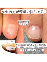 ヒューマン鍼灸接骨院/深爪育成【1】