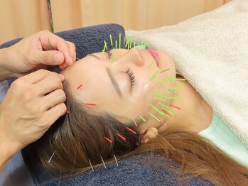 ノア鍼灸整骨院(NOA鍼灸整骨院)/