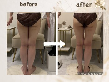 ラムール(L'amour)/美脚・小尻になりたい方必見