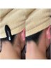 【夏前の今がチャンス！首すじスッキリ計画】うなじワックス+光脱毛(鎮静込)