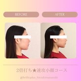 ブリリオプラス 広島並木店(Brillio Plus)