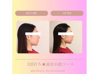 ブリリオプラス 広島並木店(Brillio Plus)