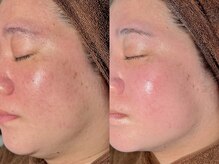 ルーナジェーナ(Luna llena)/