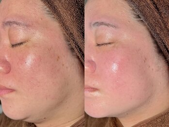 ルーナジェーナ(Luna llena)/