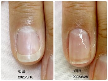 自爪育成→キープコース