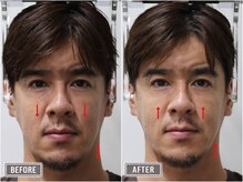 さつま骨格矯正 表参道青山院/歪み小顔矯正＋骨盤矯正