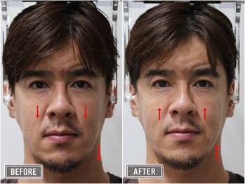 さつま骨格矯正 表参道青山院/歪み小顔矯正＋骨盤矯正