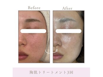 サロン アンジュ(salon.anju)