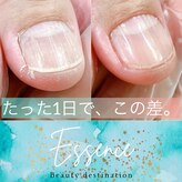 エッセンス (Essence)