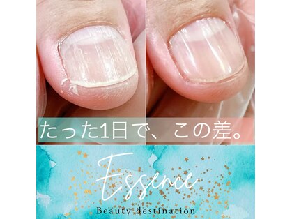 エッセンス (Essence)の写真