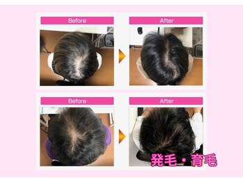 ふじもと整体院/抜け毛(美容サロンで個室)