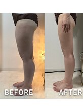 リュミエール(Lumiere)/下半身スリム