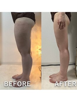 リュミエール(Lumiere)/下半身スリム