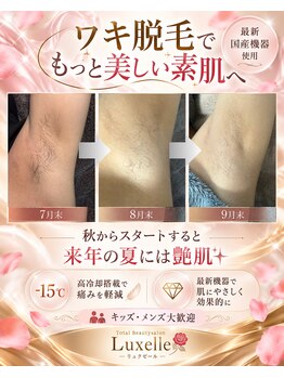 リュクゼール(Luxelle)の写真/最新国産脱毛器で高冷却な全身脱毛を。都度払いでお気軽に試せる美肌ケア◎光フェイシャルと併用可能!!