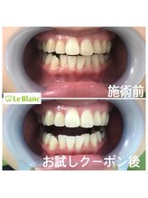 ルブラン 奈良店(Le Blanc)/お客様のご紹介で！！