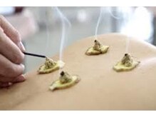 ビヤンネートル/お灸で芯から温まりましょう♪