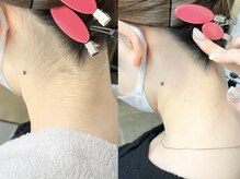 ネリネ 天神(nerine)/うなじワックス/うなじ脱毛