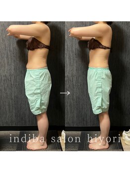 ヒヨリ(hiyori)/《before/after》body