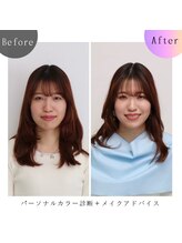 シュアリー(Surely)/トータルコースお客様事例