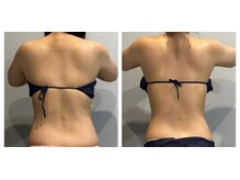 ラヴィエール(Laviere)/【レディース痩身120分】1回目